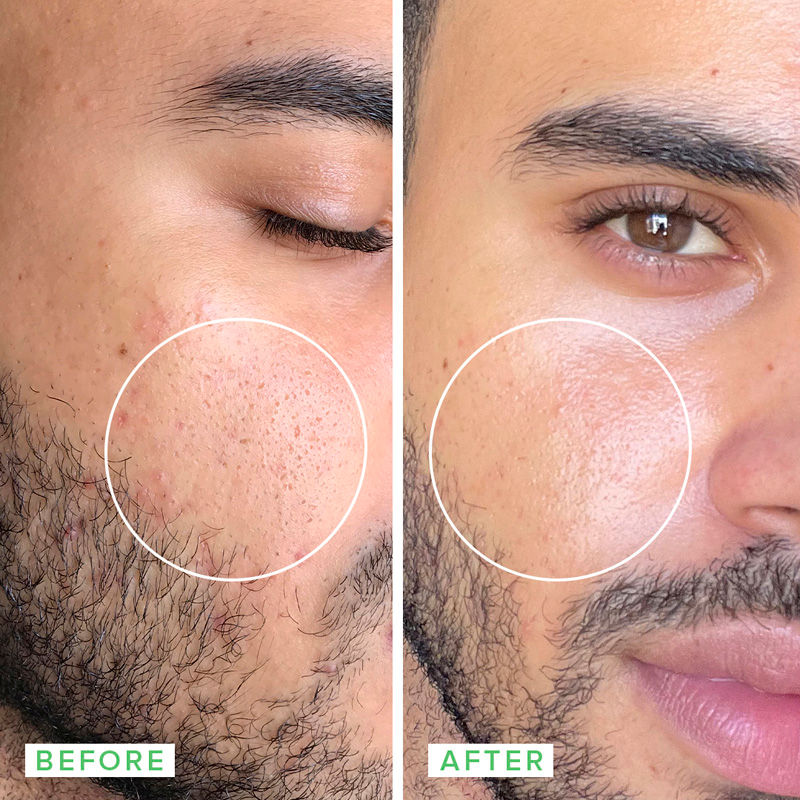 Deep Sweep 2% BHA Pore Cleaning Toner With Salicylic Acid & Moringa Water