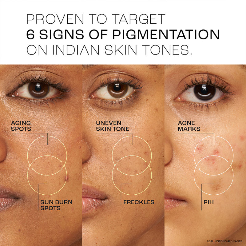 Perfect Radiance Pigmentation Treatment Gel with 10% Niacinamide Resorcinol Complex, 50g