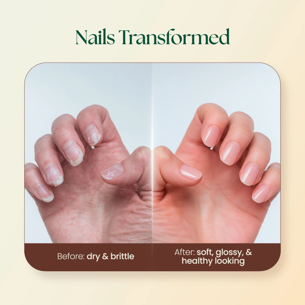 Nail Care Cream Strengthen Dry Nails And Promote Shiny Glow