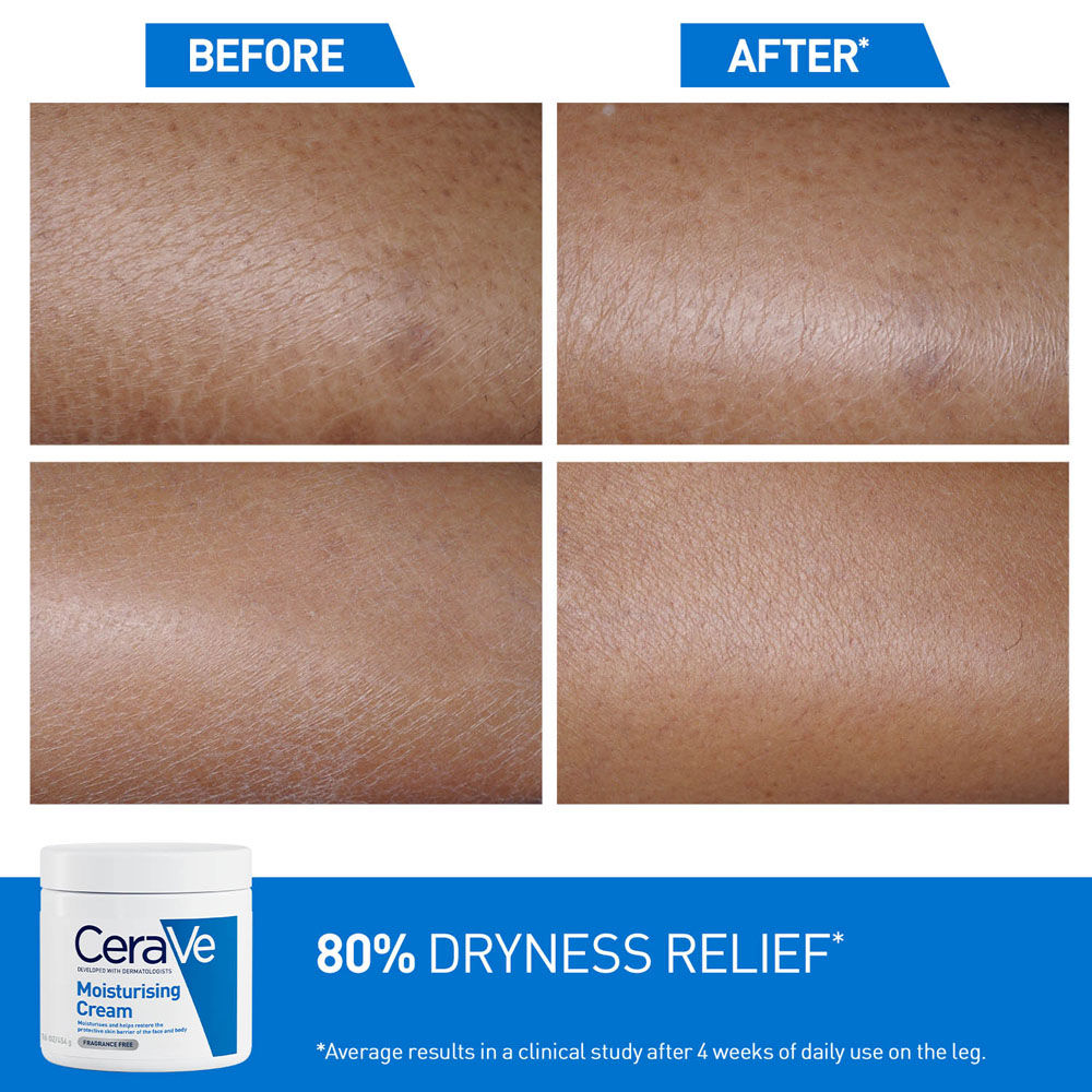 Moisturizer For Dry Skin, Barrier Repair Cream with Ceramides, Dermatologist recommended