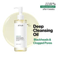 Heartleaf Pore Control Cleansing Oil Removes Makeup, Excess Sebum, Blackheads & Clogged Pores