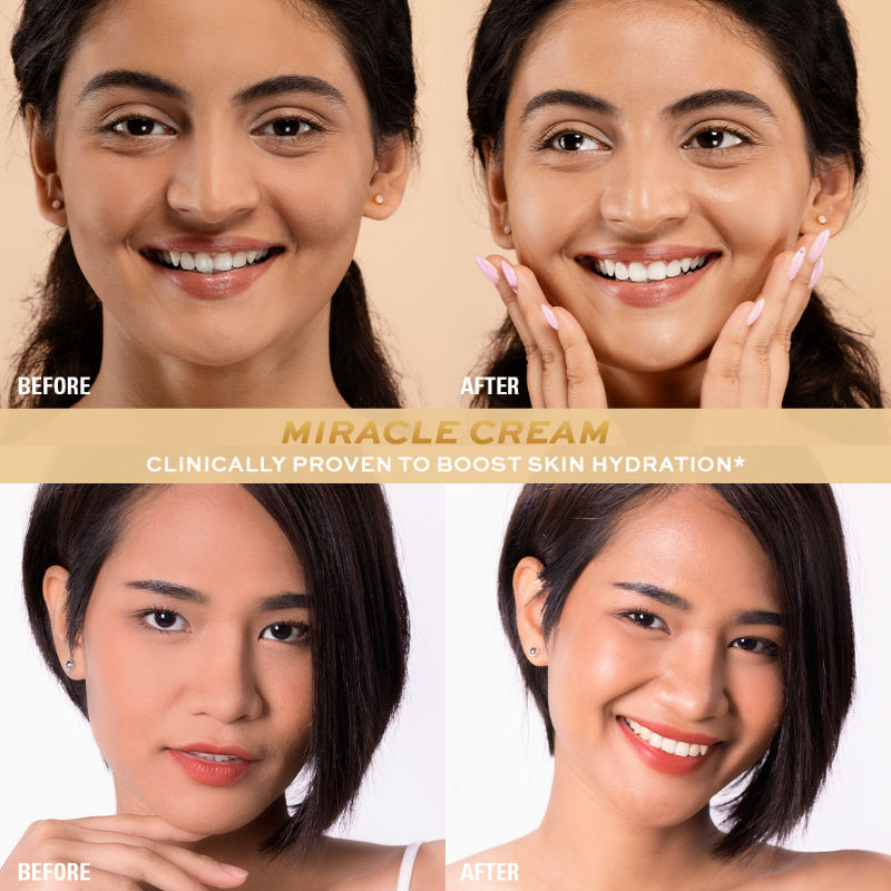 Miracle Cream