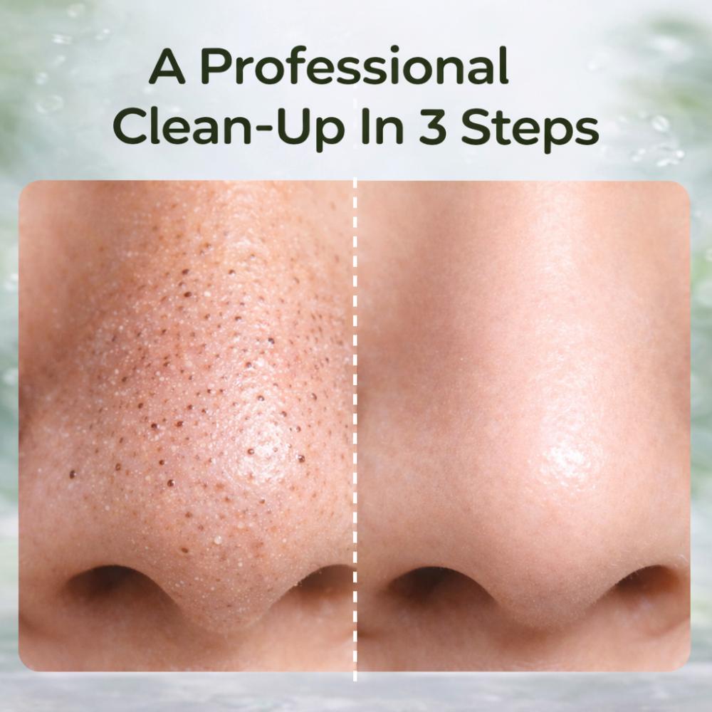 Deepdetox 3-In-1 Nose Strips For Blackhead Removal