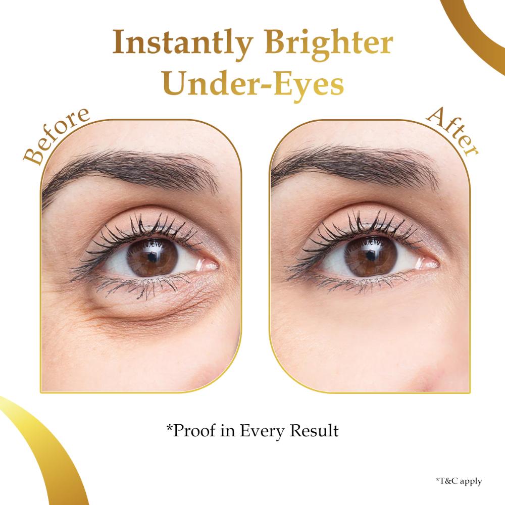 Hydrogel Undereye Patches For Dark Circles & Puffiness