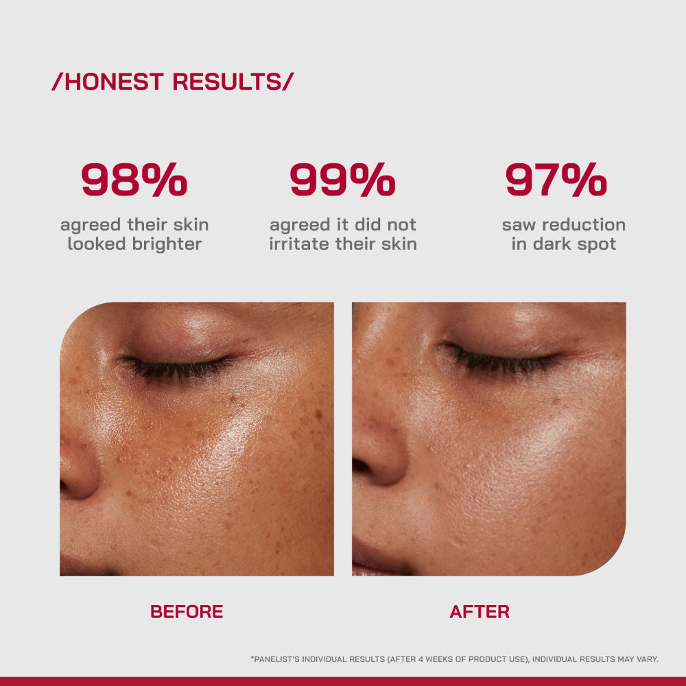 (PHD) 10% Vitamin C Brightening Serum