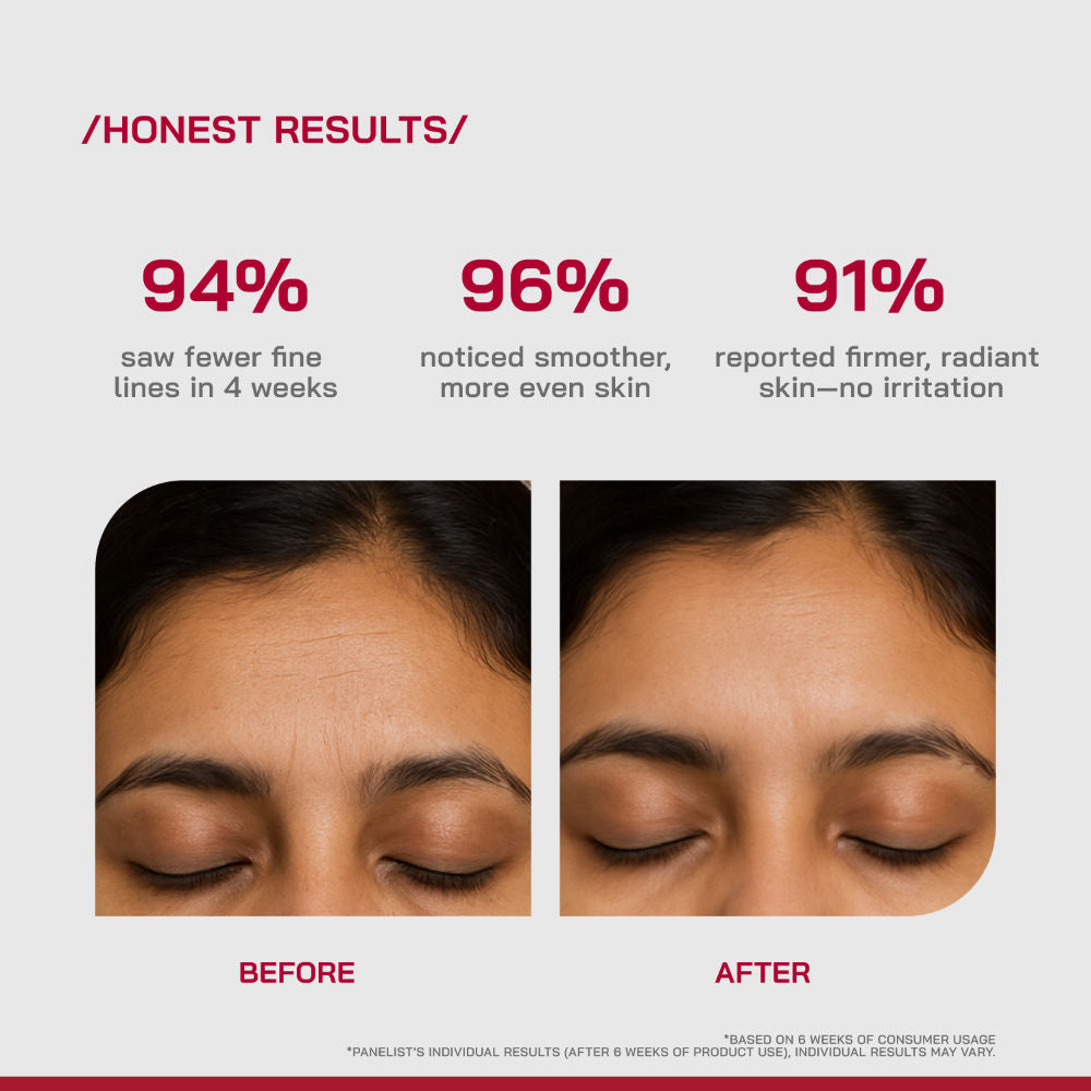 (PHD) 0.3% Retinol Serum With Bakuchiol & Peptides
