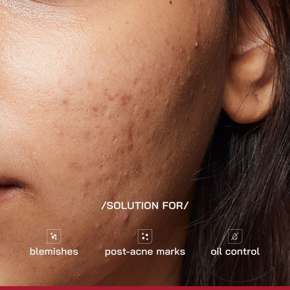 (PHD) 10% Niacinamide Spot Correcting Serum