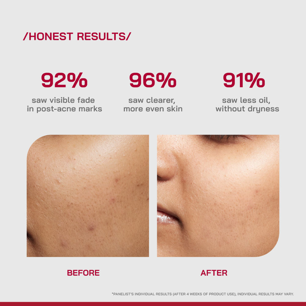 (PHD) 10% Niacinamide Spot Correcting Serum