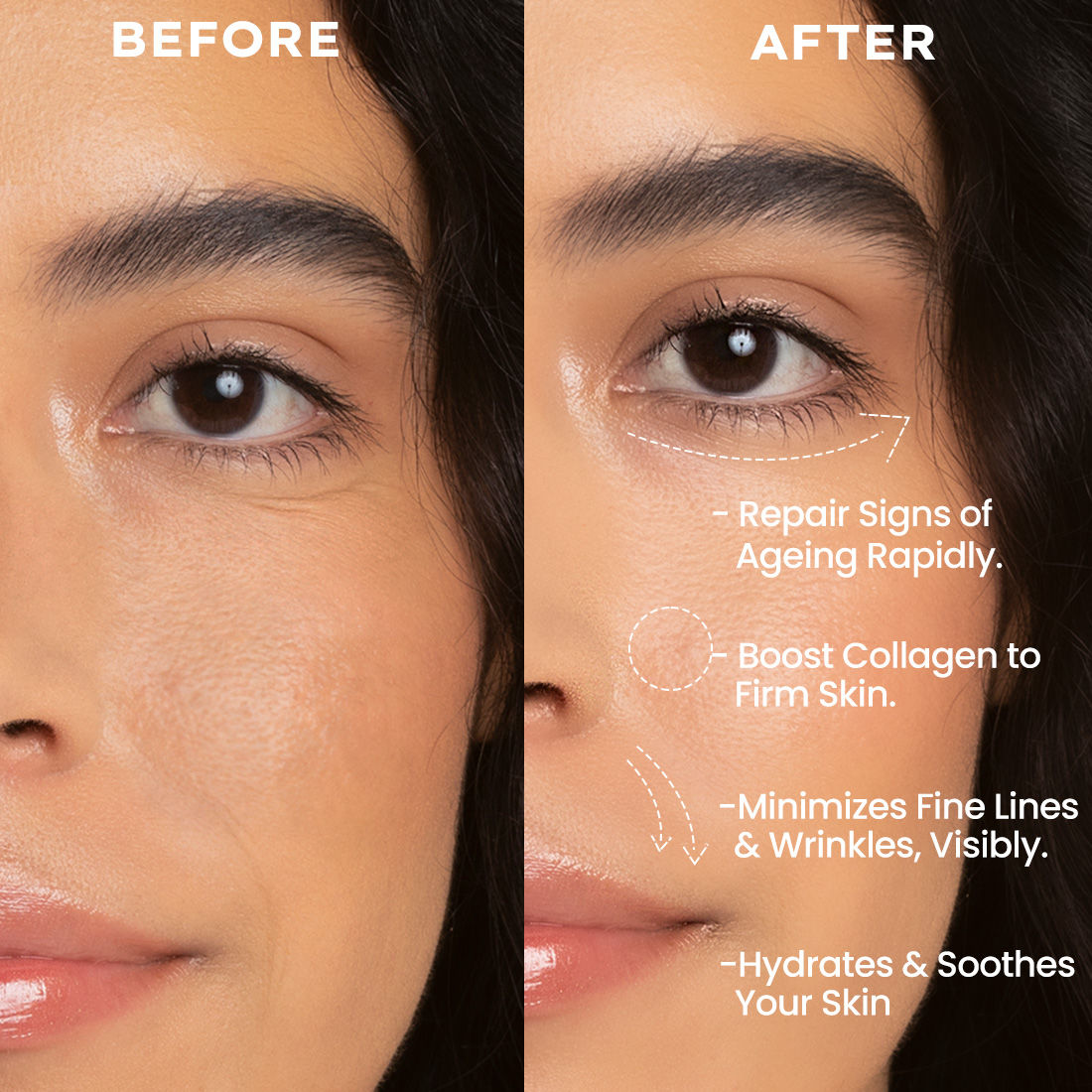 0.1% Retinal Reset, Retinol Derivative Serum Pro For Anti Aging, Reduce Fine Lines & Wrinkles