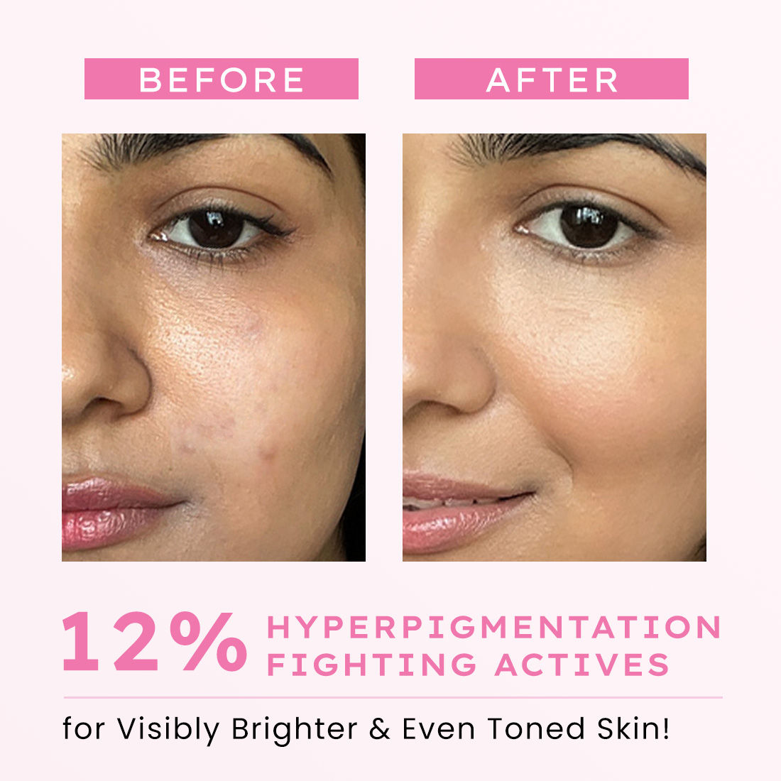 Advanced De-Pigmentation Serum
