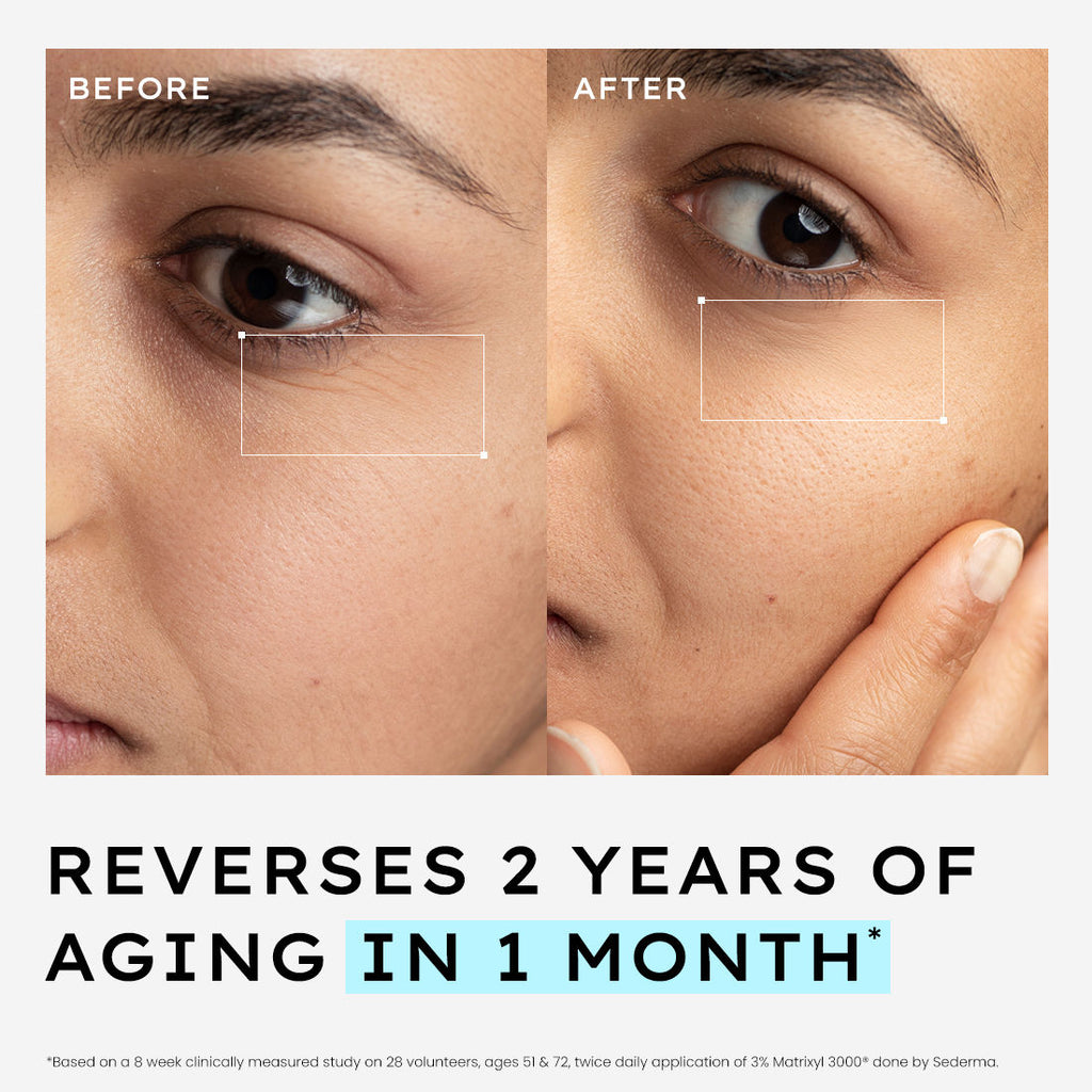 10% Power Peptide Cocktail Serum