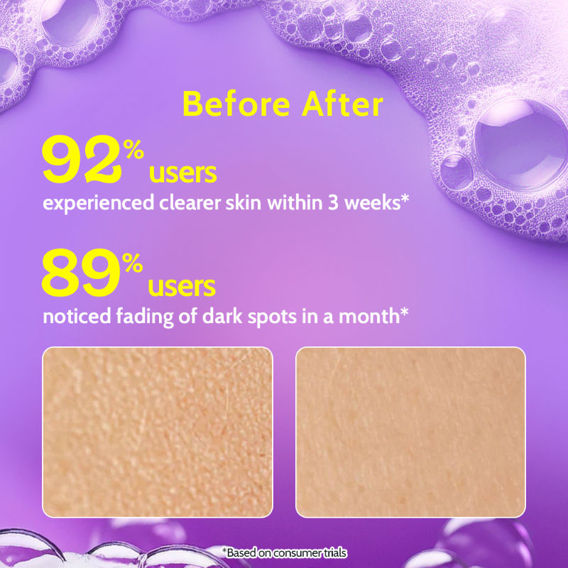 Vitamin C Brightening Face Wash Face Cleanser for Oily&Dry Skin