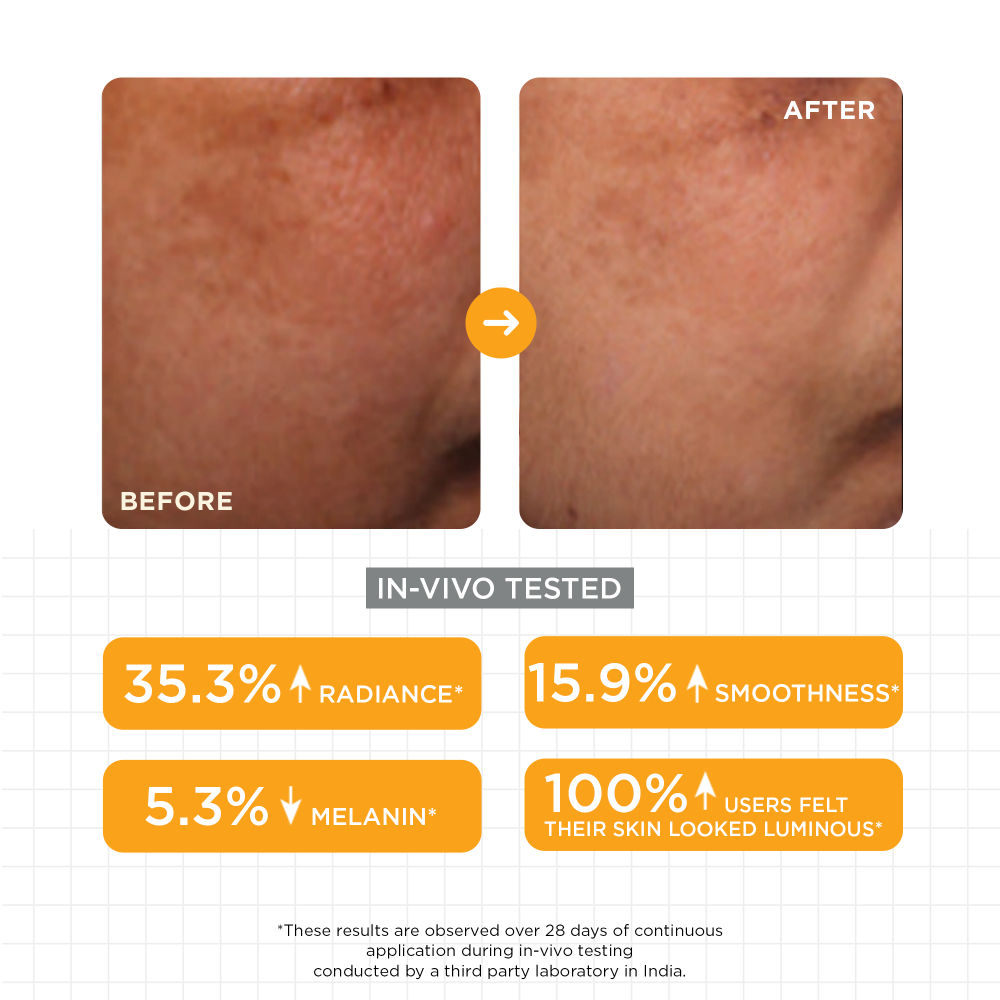 Brightening Serum with Lactic & Malic Acid