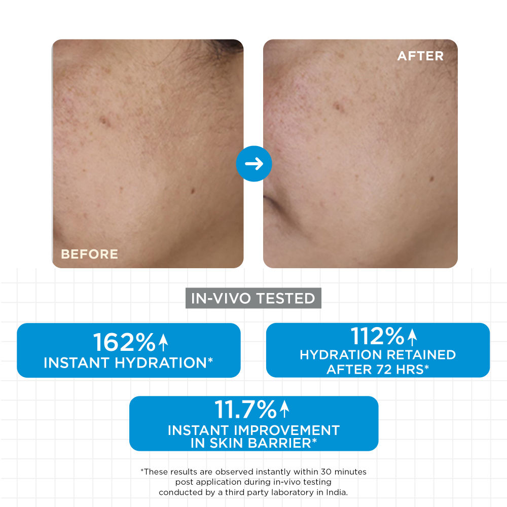 Moisture Balm with Ceramides Trio, Sodium Hyaluronate & Vitamin E, For Dry Skin
