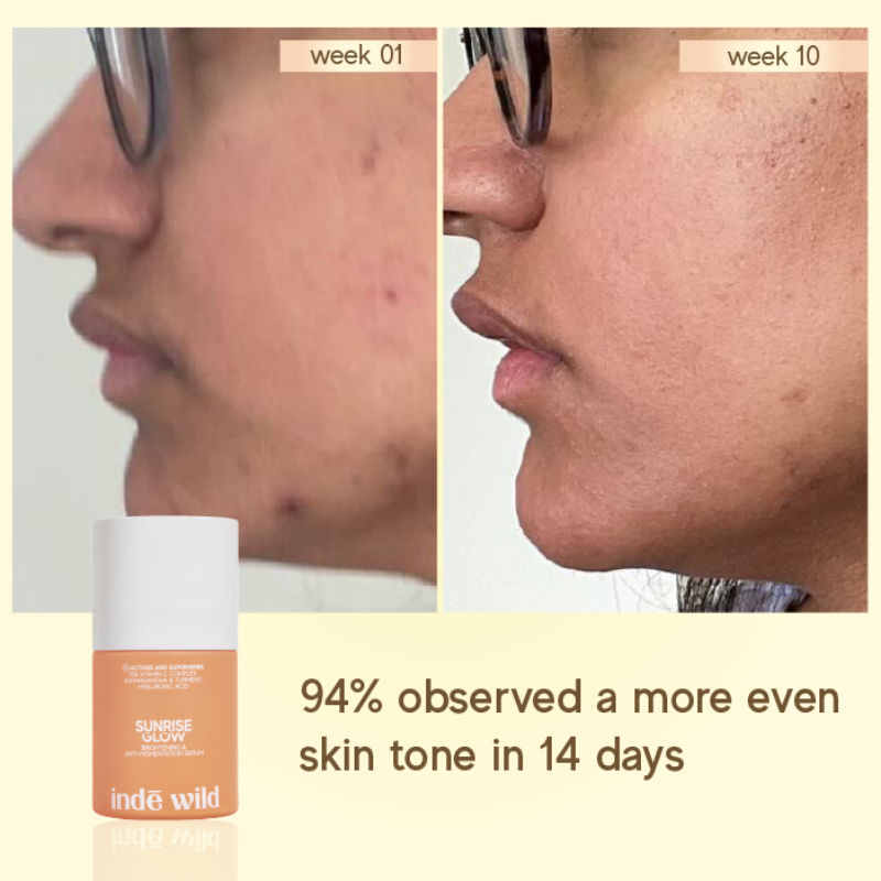 Sunrise Glow 15% Vitamin C Complex Serum