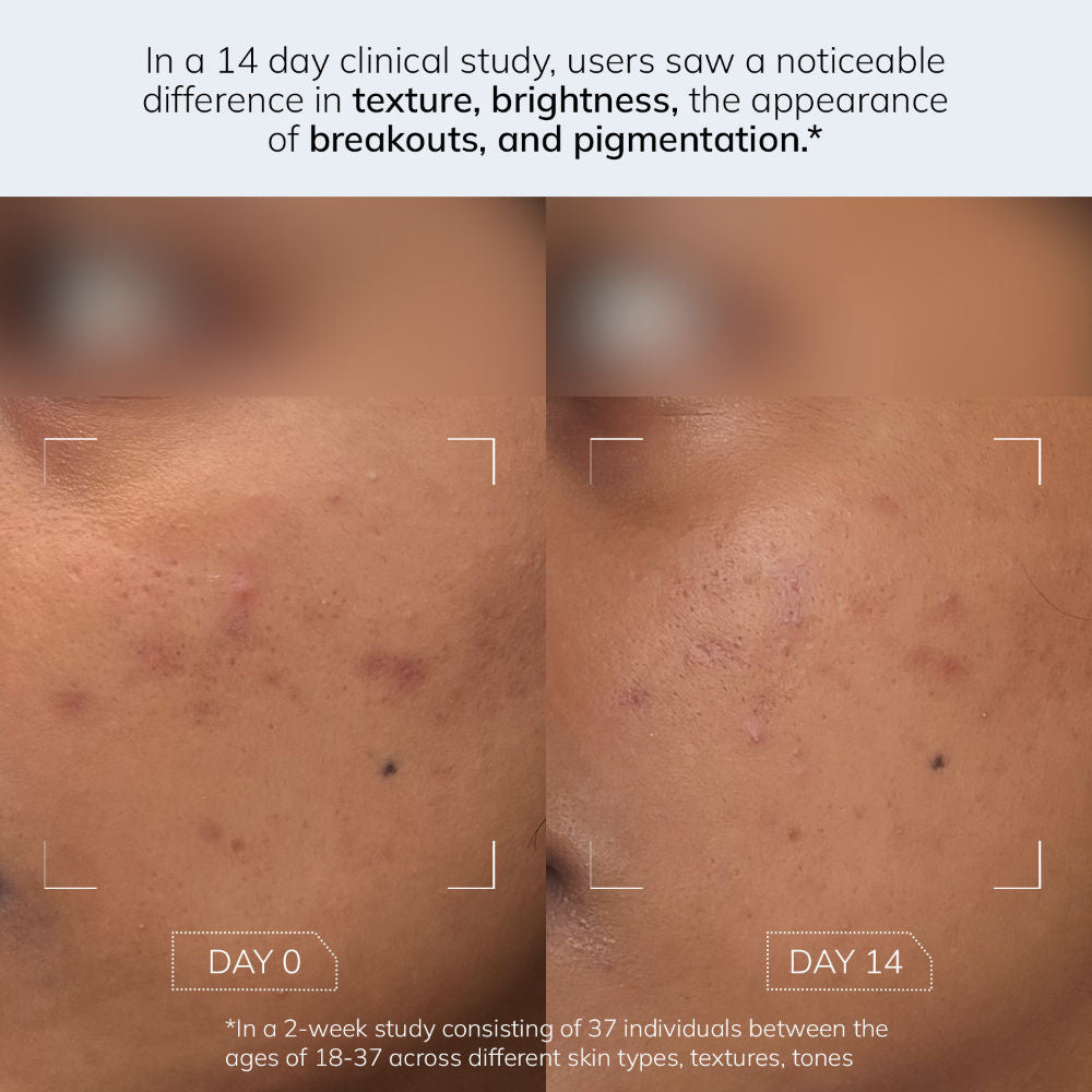 Evening Exfoliator Gentle Bi-Phasic Exfoliating Toner