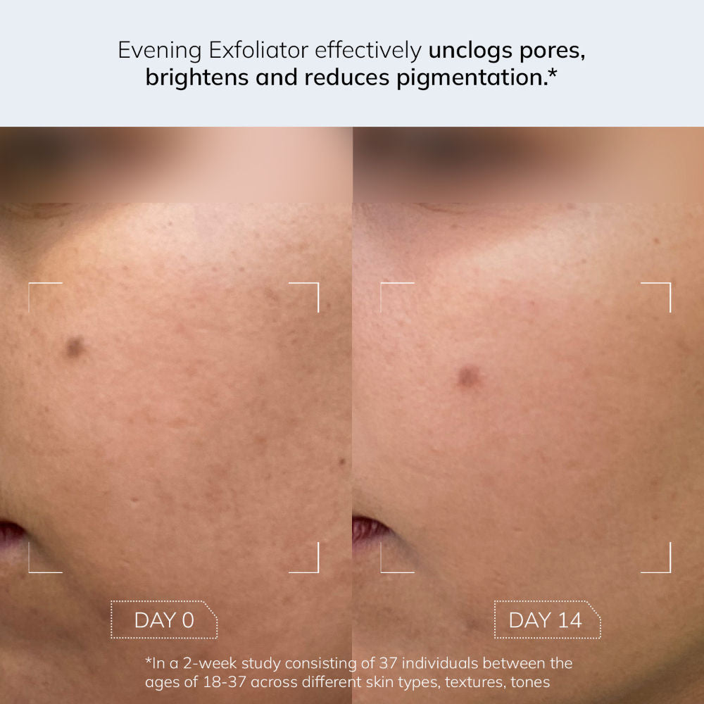 Evening Exfoliator Gentle Bi-Phasic Exfoliating Toner