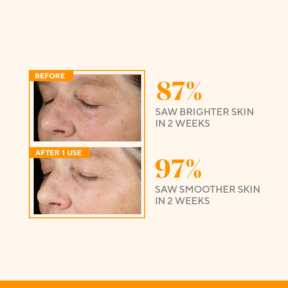 Environmental Shield Vitamin C Triple Exfoliating Facial