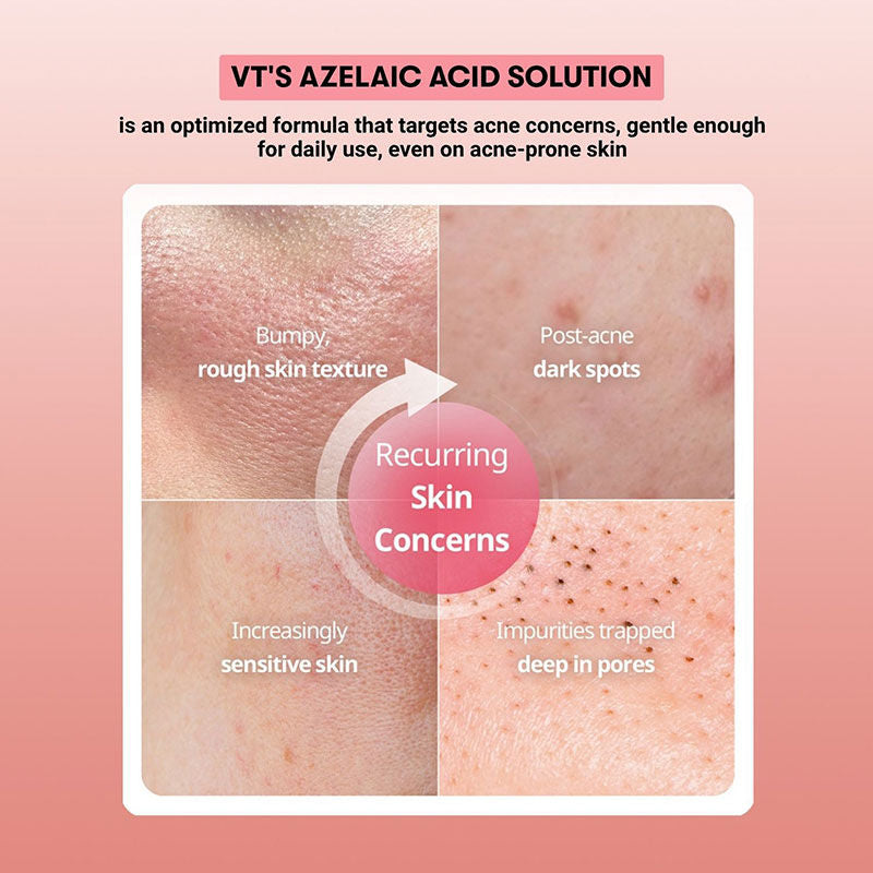 Azelaic Acid Capsule Cream