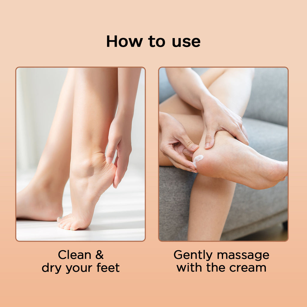 10% Urea Natural AHAs Foot Cream - 1% Salicylic Acid Shea Butter Tea Tree Oil Aloevera Extract