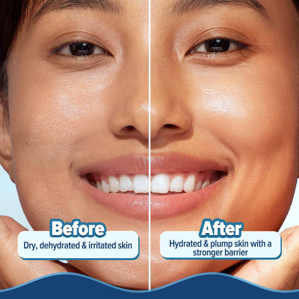 Barrier+ Hydra Gel Moisturizer With 5 Ceramides & Avocado For 24 Hour Intense Hydration