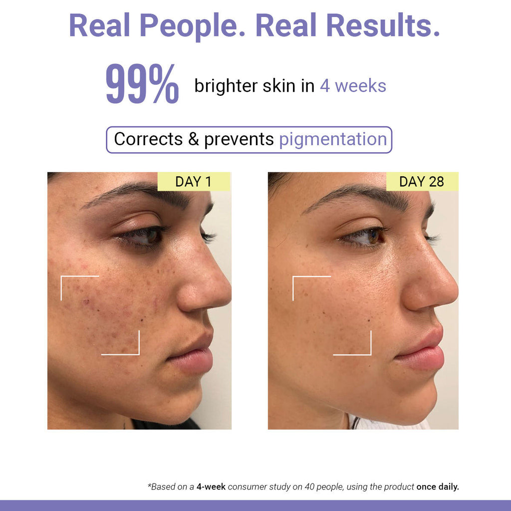 Vit C Night Cream with Niacinamide for Tan Removal & Pigmentation