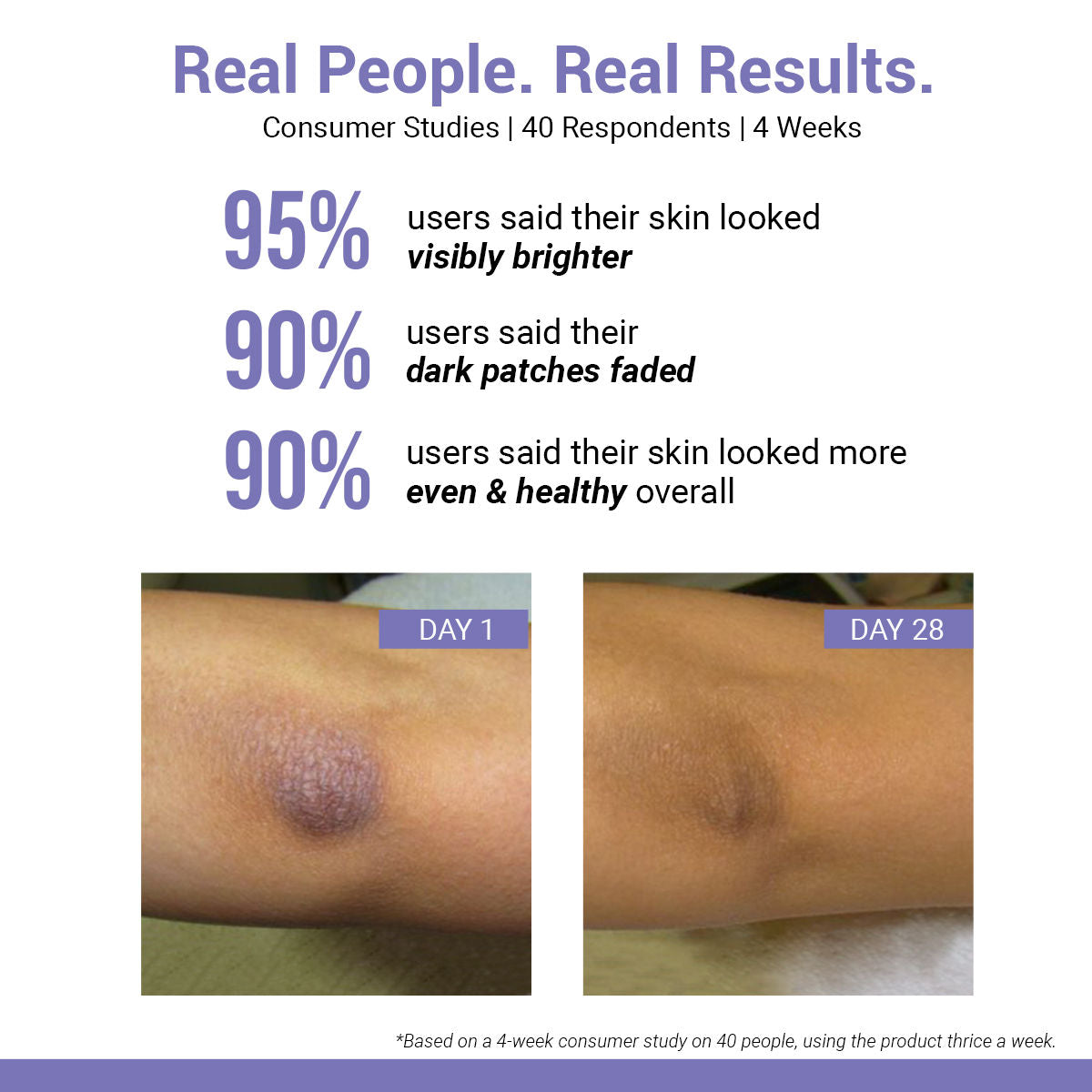 Vitamin C Body Scrub for Tan Removal, Ingrown Hair & Body Exfoliation