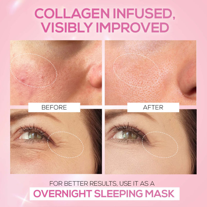 RENEE Pink Therapy Hydrolyzed Collagen Overnight Sleeping Jelly Mask for Antiaging & Hydrated Skin