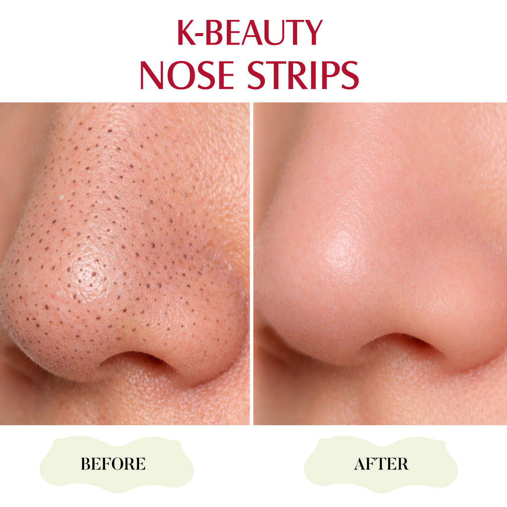 K-Beauty Nose Strips - Charcoal