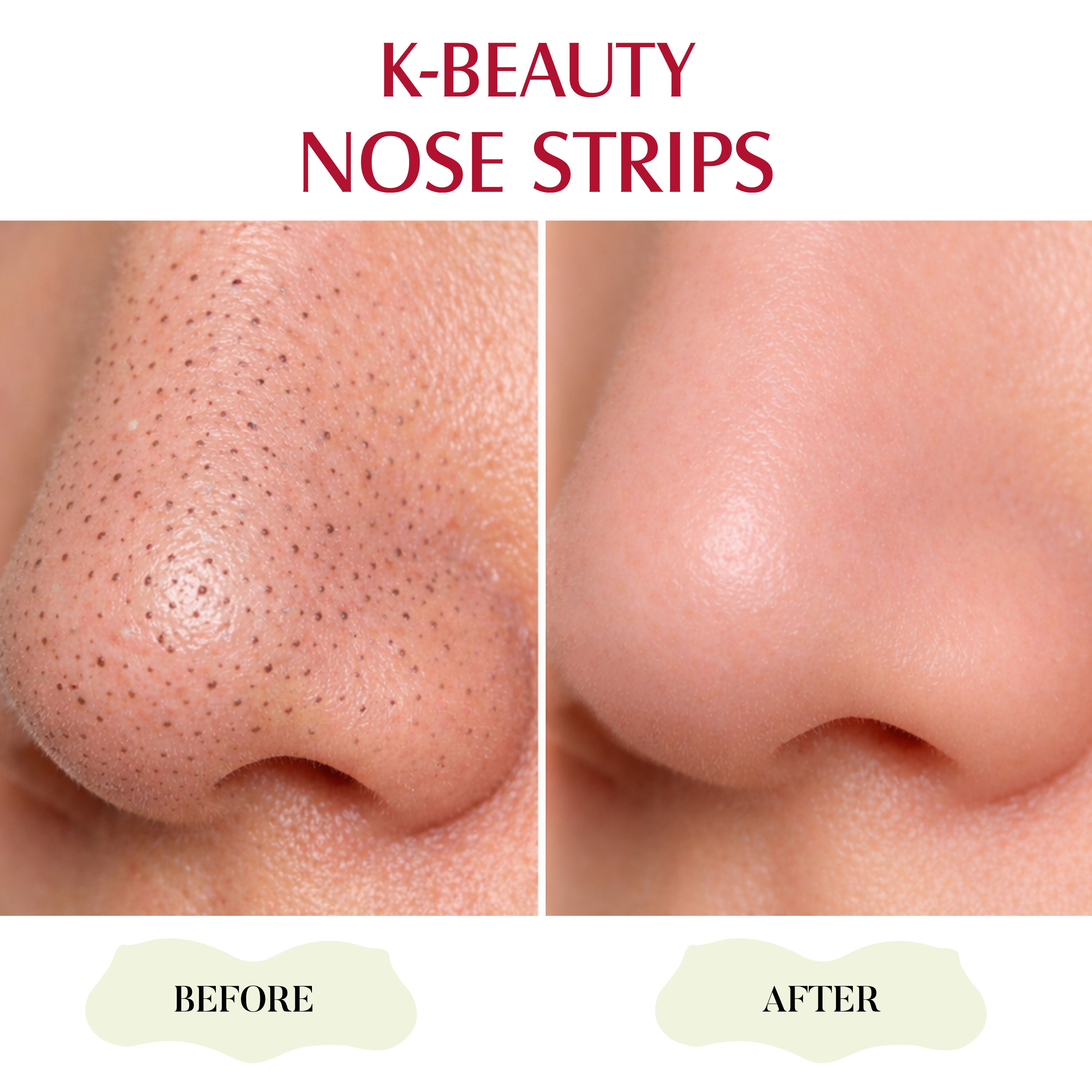 K-Beauty Nose Strips - Witch Hazel