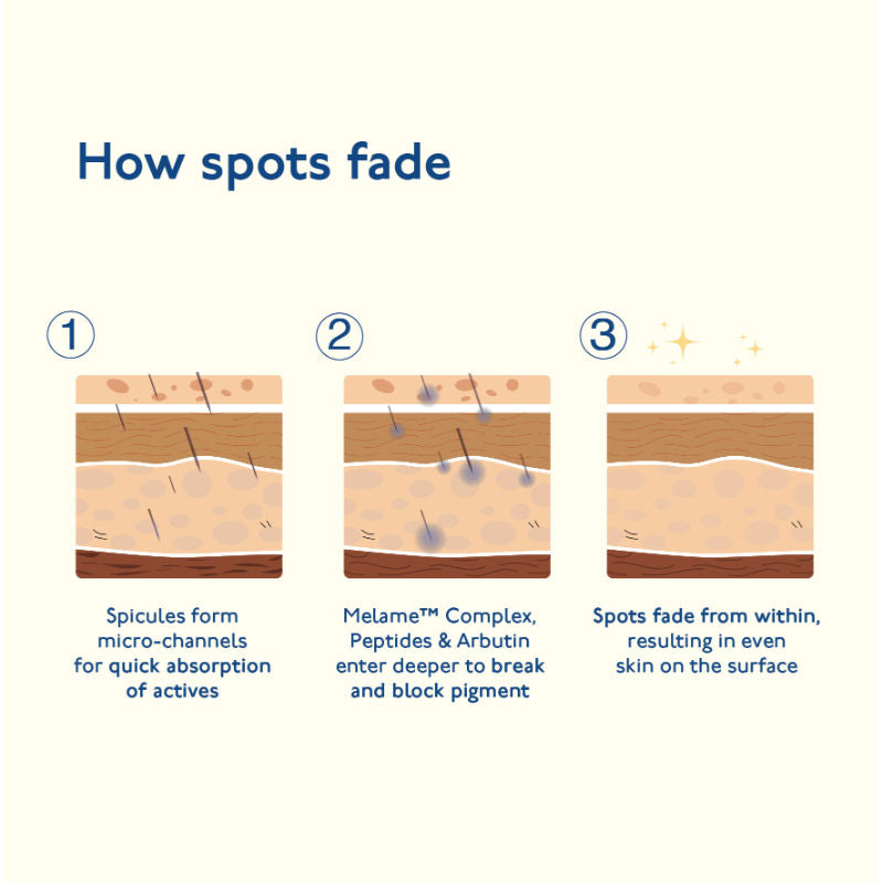 Advanced Dark Spot Gel for Pigmentation Acne Marks with MelaMe & Alpha Arbutin All Skin Type