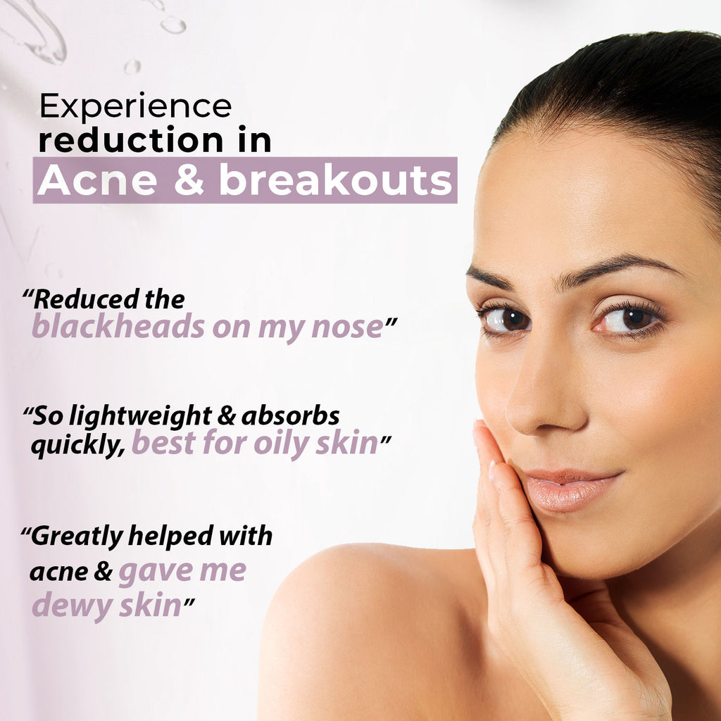 Acne Care Purifying Nourisher, Gentle/light/non-greasy daily Moisturizer for oily & pimple prone skin, 50 ml