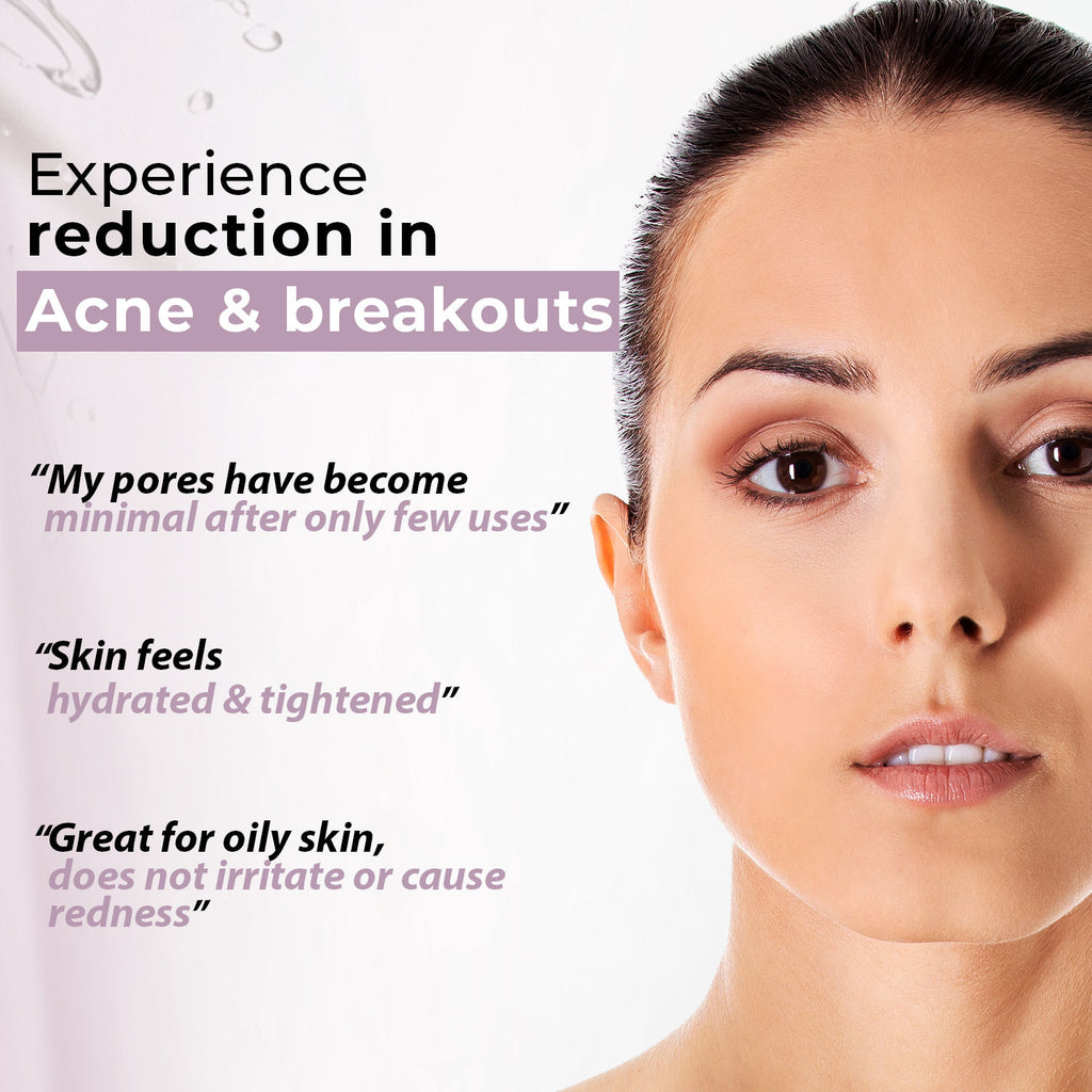 Acne Care Purifying Toner | Alcohol Free Toner With Niacinamide | Acne Prone Skin | Gentle Exfoliation| Clears Acne & Pimples|For Oily & Combination Skin | 100m