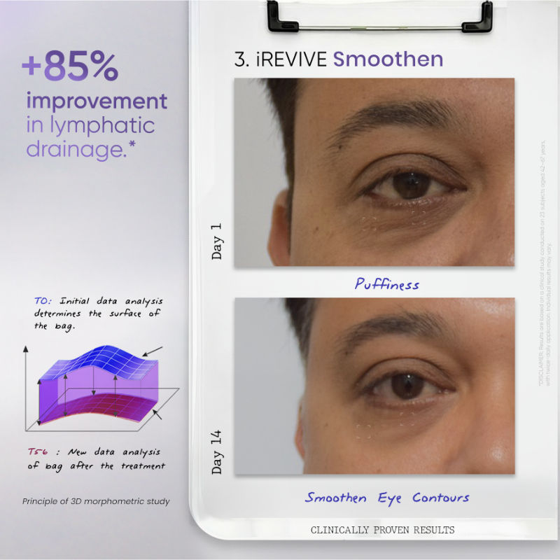 iREVIVE Dual Chamber Under Eye Serum, Brightening & De-Puffing Eye Treatment