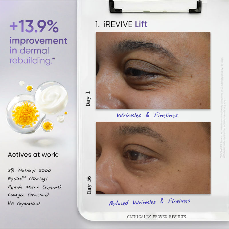 iREVIVE Dual Chamber Under Eye Serum, Brightening & De-Puffing Eye Treatment