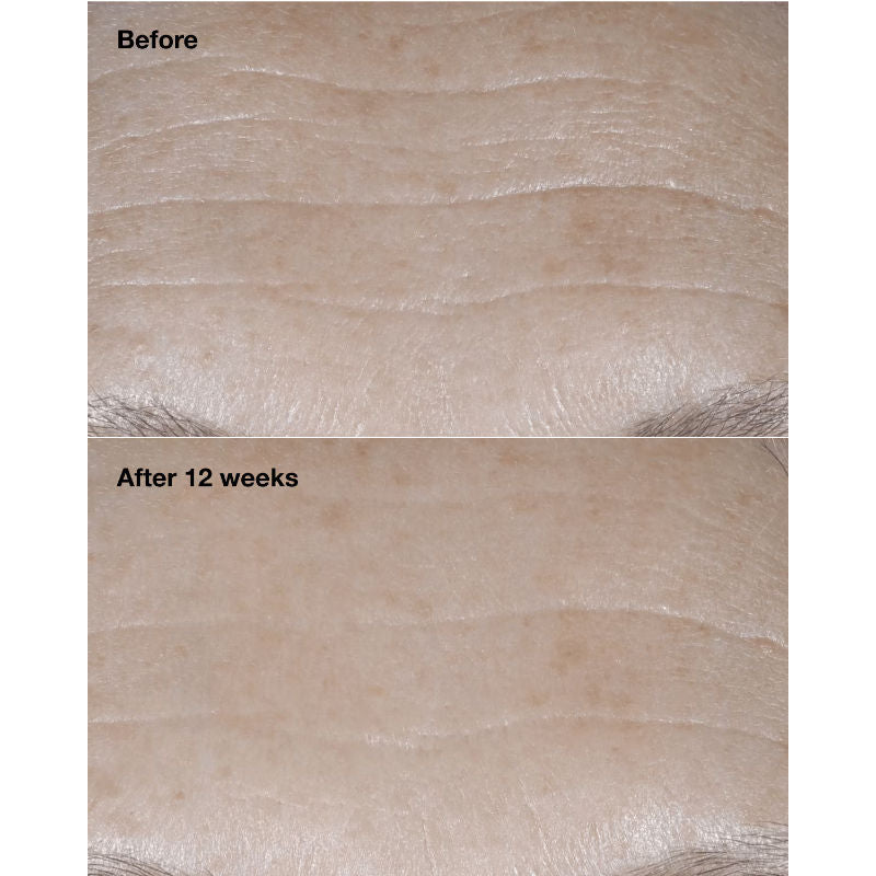 Smart Clinical Repair Wrinkle Correcting Cream With SPF 30