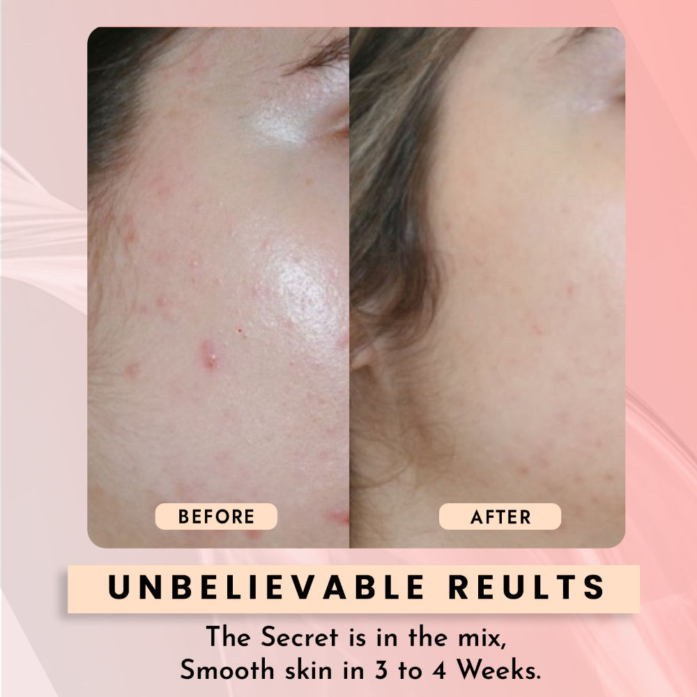 10% Niacinamide Face Serum for Pore Minimizing & Even Skin Tone