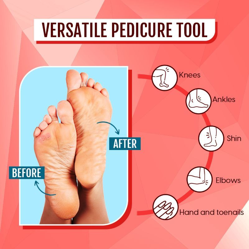 Foot Filer Scrubber 4-in-1 Pedicure Brush Dead Skin, Callus Removal Heels Scraper Pumice Stone