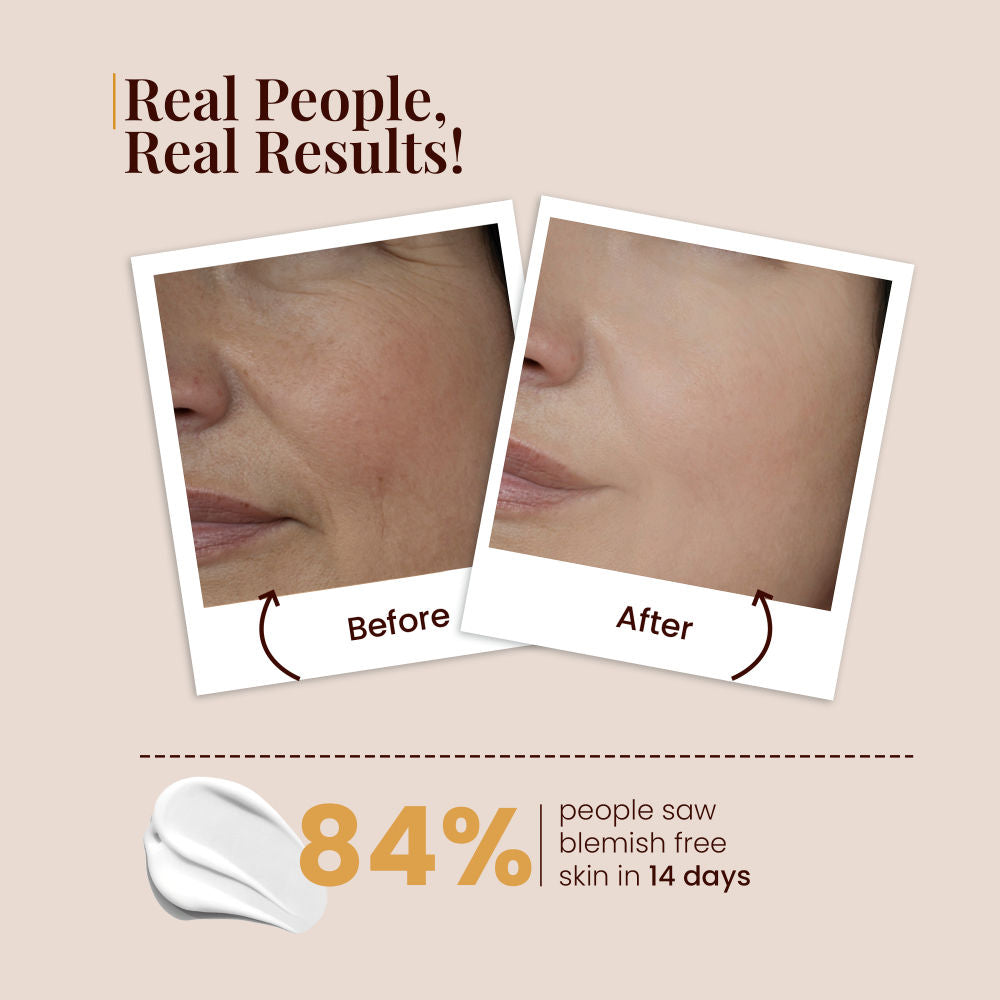 Ubtan Day Cream Spf 15 With Saffron For Glowing Skin & Tan Removal, Oil-Free Cream