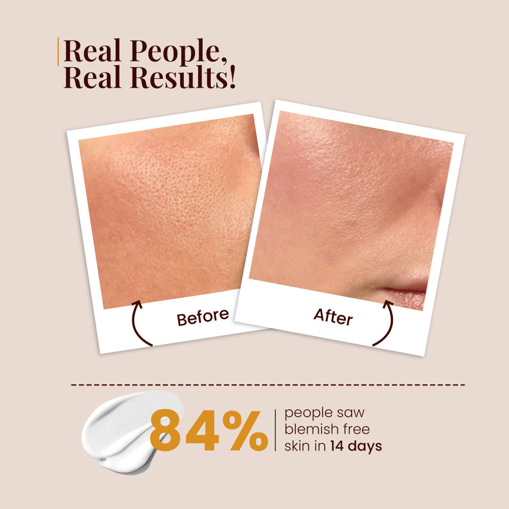 Ubtan Night Cream With Saffron For Glowing & Spot Free Skin, For Oily & Dry Skin