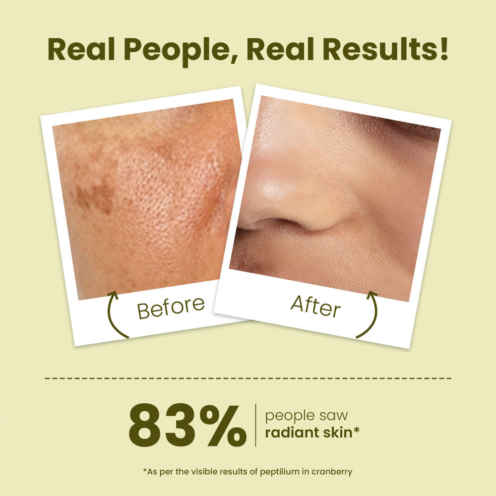 Young Forever Anti-Aging Night Repair Cream With Bakuchi For Fine Lines & Wrinkles