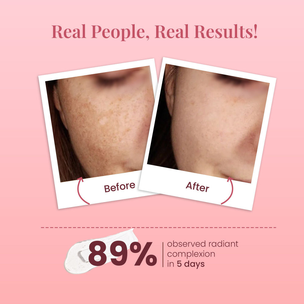 Ideal Bright Night Cream With Kakadu Plum For Pigmentation & Dark Spots, Oil-Free Cream