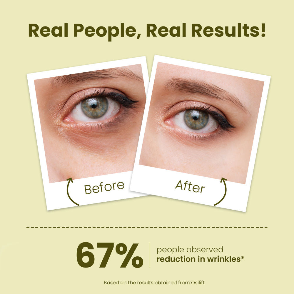Young Forever Hydrating Under Eye Serum With Niacinamide For Dark Circles & Puffy Eyes