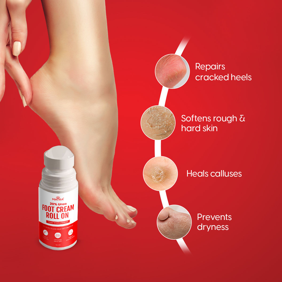 20% Urea Foot Cream Roll On For Cracked Heels & Dry Feet With Lactic Acid - Softens & Repairs