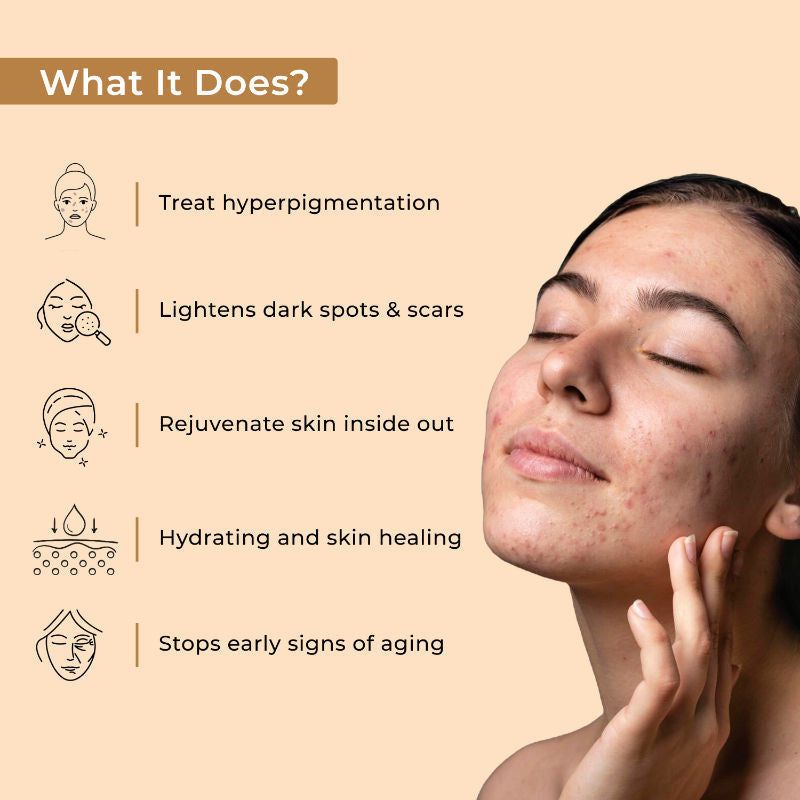 Yogurt & Honey Depigmentation Gel, Skin Brightening & Lightening