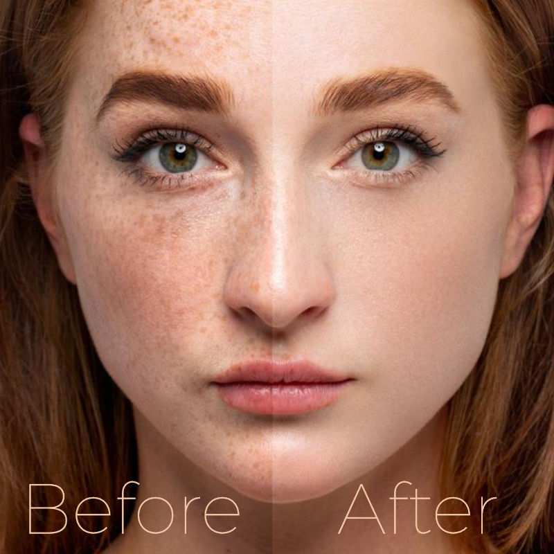 Yogurt & Honey Depigmentation Gel, Skin Brightening & Lightening