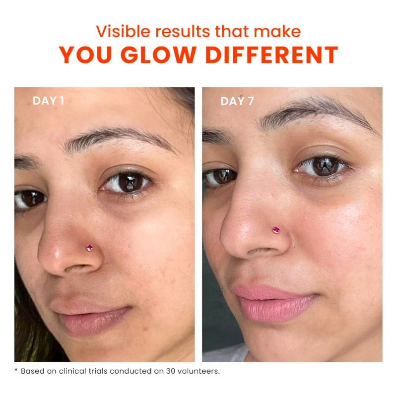 Dewy Sunscreen SPF 70 PA++++ With Niacinamide + Provitamin B5 + Vitamin E