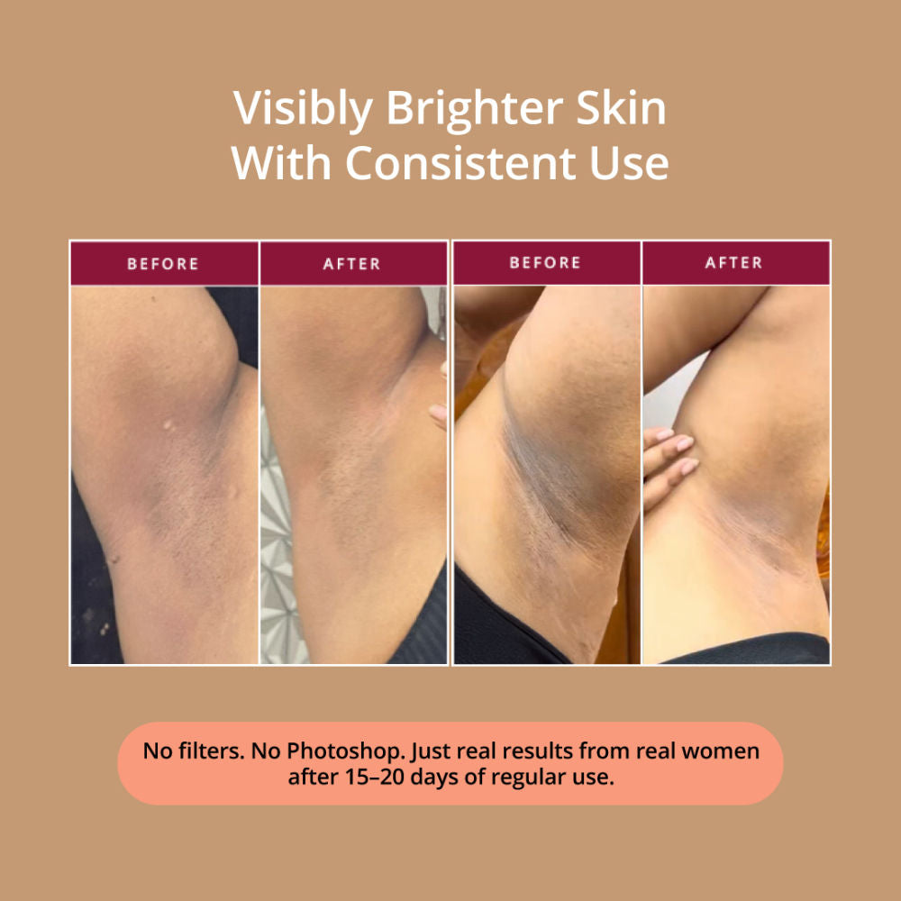 Glow Revive Underarm Roll On, Rice Water, AHAs for Pigmentation & Odour Control