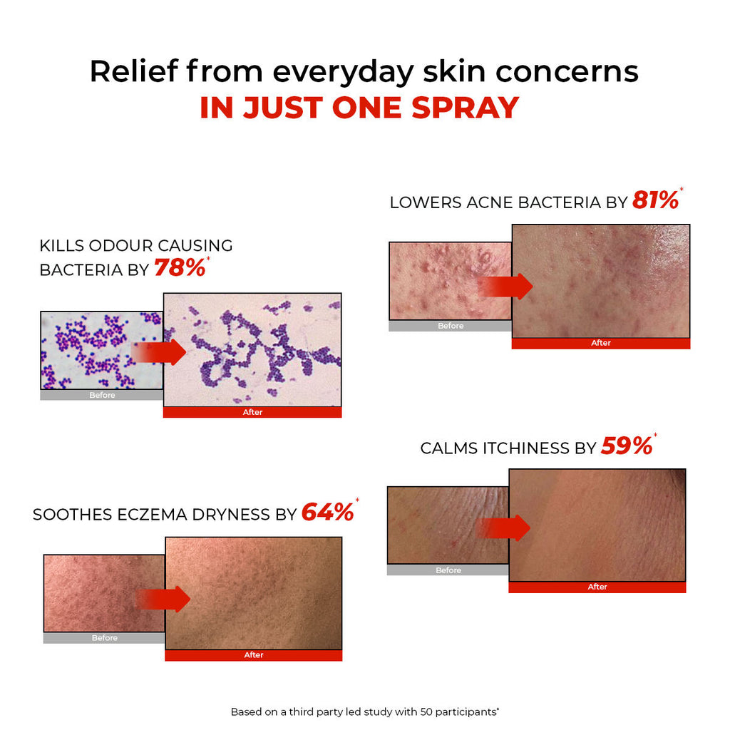 HOCL Skin Relief Face & Body Spray