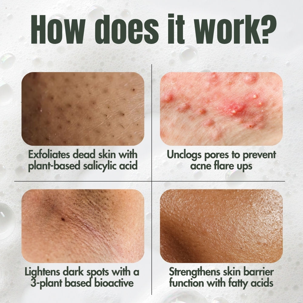 Ingrown Hair Treatment